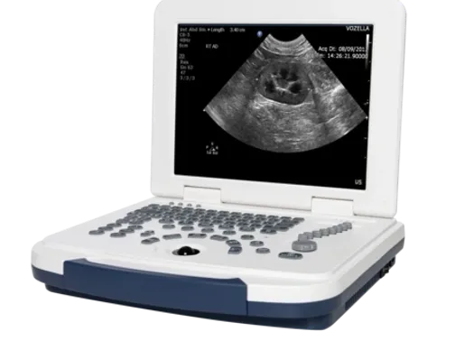 SmartBreeder Portable Ultrasound Scanner used by Tails of Gloucester